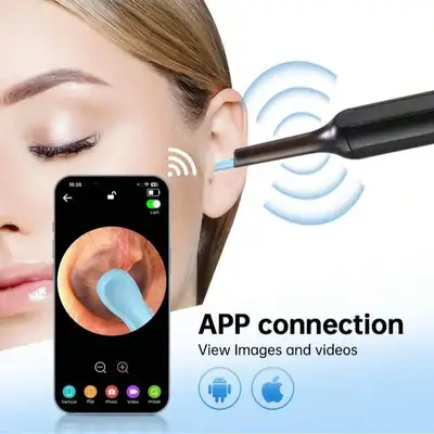 NETTOYEUR D'OREILLE OTOSCOPE CONNECTÉ WIFI HD
