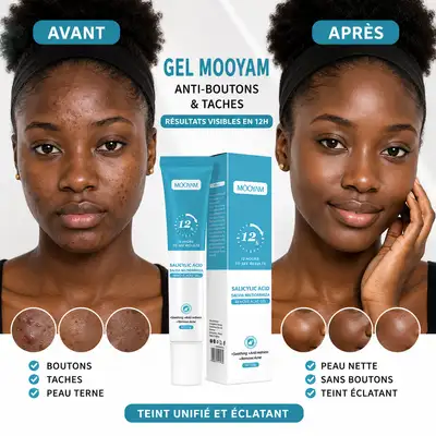Dites Adieu aux Boutons et aux Taches avec ce Gel