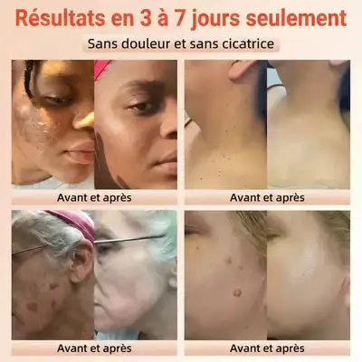 Gel Exfoliant Orange Éclat Intense Anti-Taches